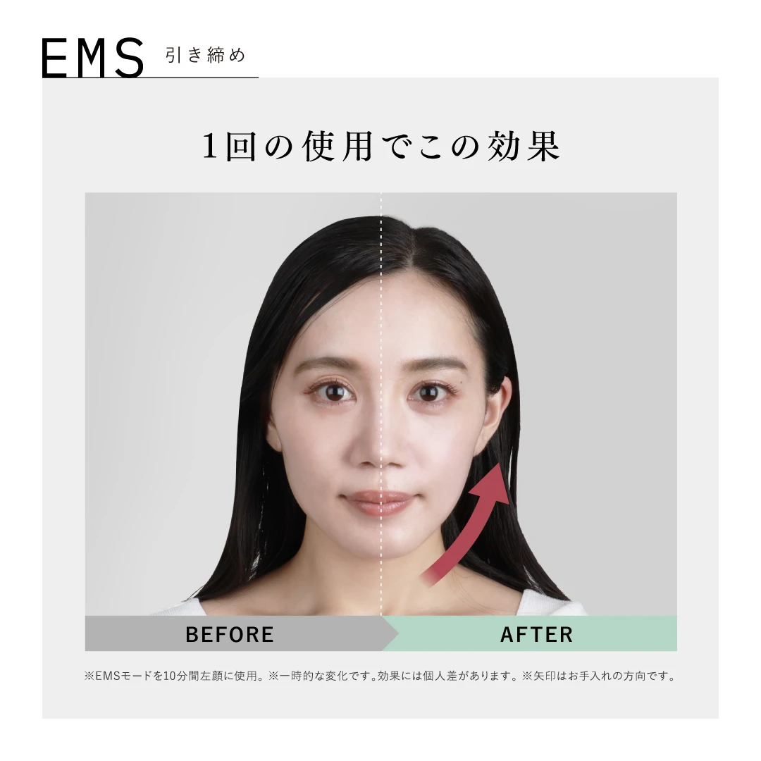 アンド クレアージュ フォトスキンデバイス | アンファースカルプD公式