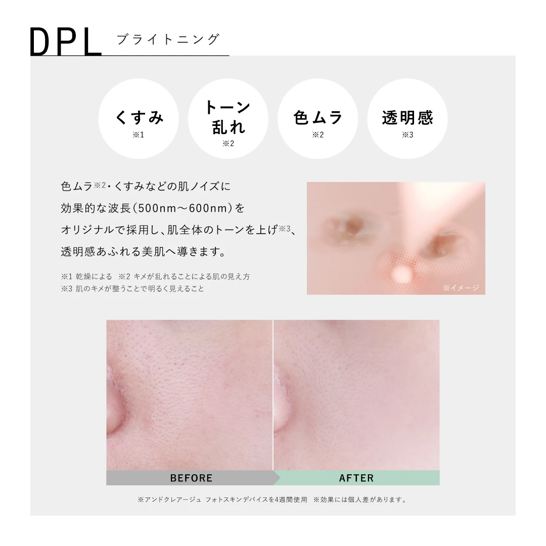 アンド クレアージュ フォトスキンデバイス | アンファースカルプD公式